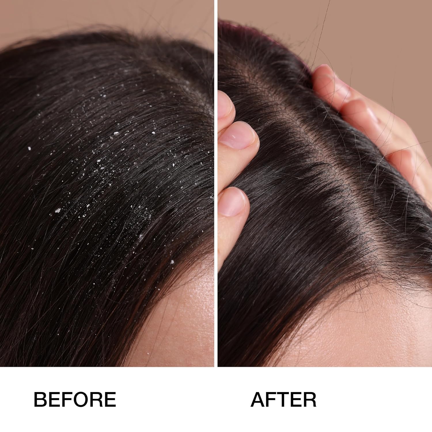 GK HAIR Anti-Dandruff Shampoo Leaving Your Scalp Refreshed and Hair Soft, Smooth – Sulfate-Free Shampoo for Dry Damaged Hair for Men and Women 8.5 Fl Oz