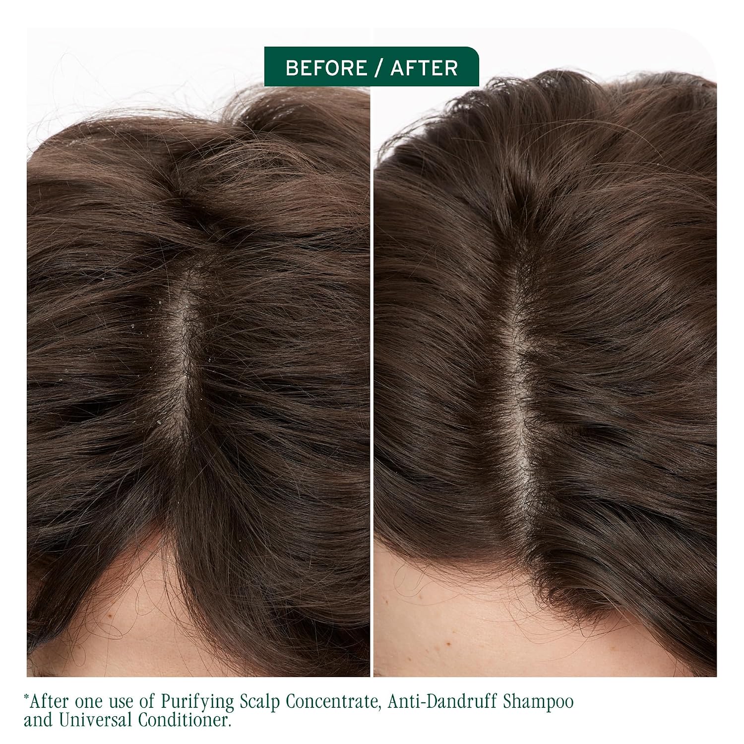 Biolage Scalp Sync Anti-Dandruff Shampoo – Controls Dandruff | Controls Itchy Scalp, Cleanses Hair, Moisturizing, Dandruff Relief, For Scalp and Hair Health, Vegan & Cruelty-Free