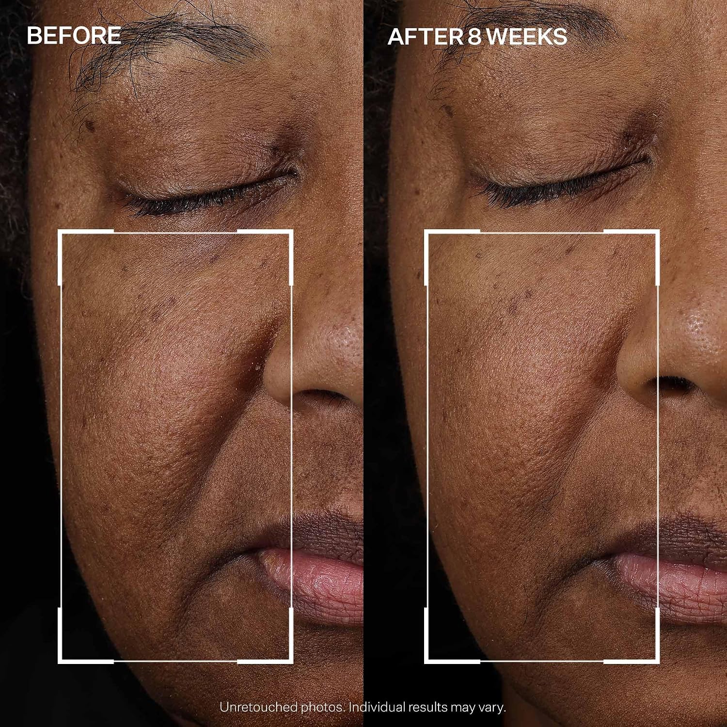 StriVectin Tighten & Lift Peptight Face Lift Serum with Tightening & Brightening Peptides for Wrinkles