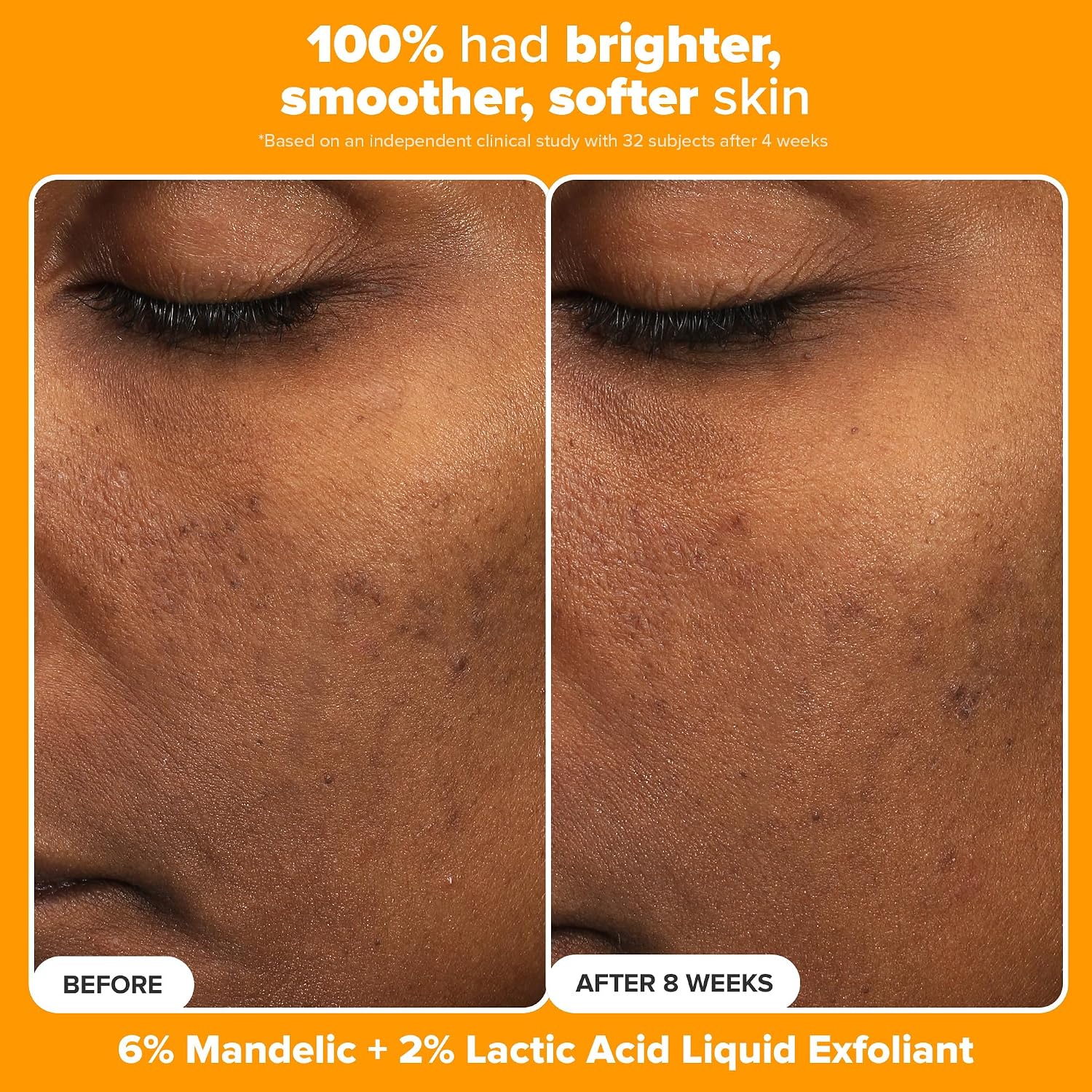 Paula's Choice BOOST C15 Super Booster 15% Vitamin C Face Serum | Daily Serum with Vitamin E & Ferulic Acid for Discoloration & Glow, Fragrance-Free
