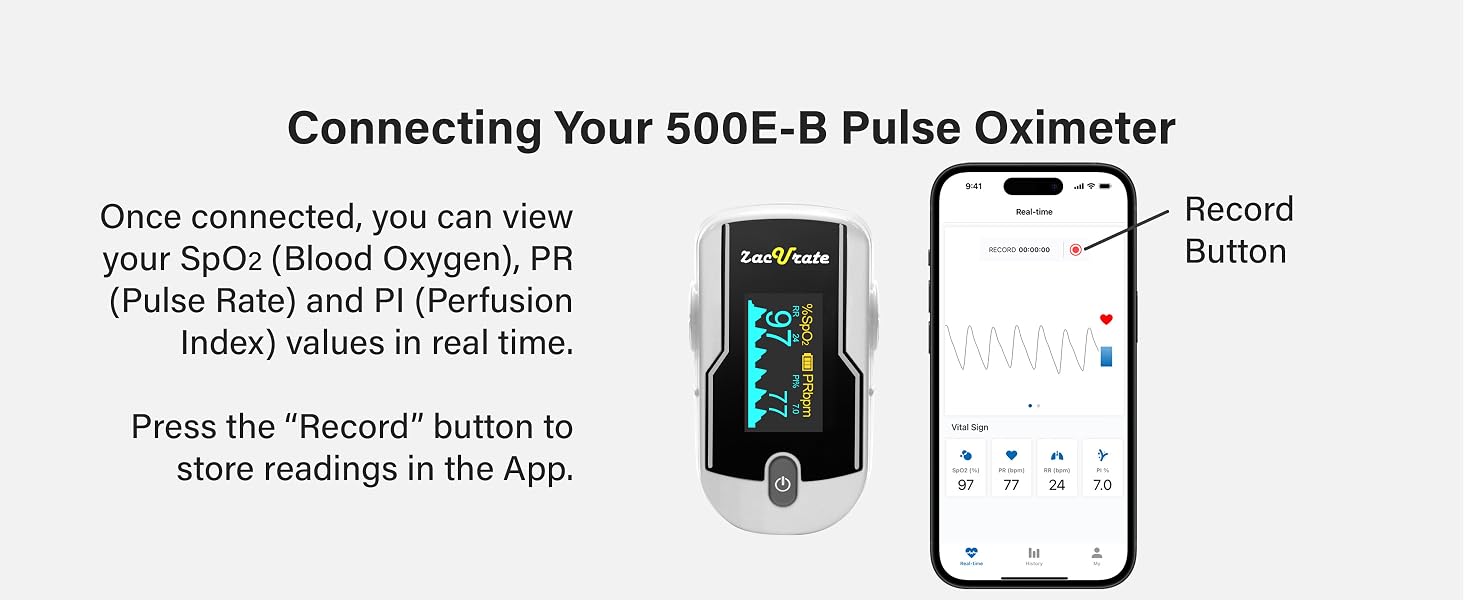 500E-B Connecting_04