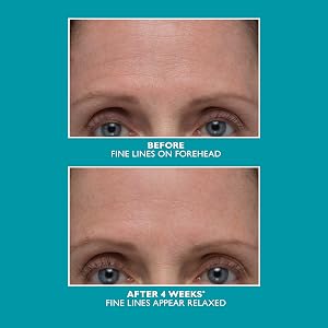 b and a, b&amp;amp;a, before and after, usage, peter thomas roth, peptide skinjection serum