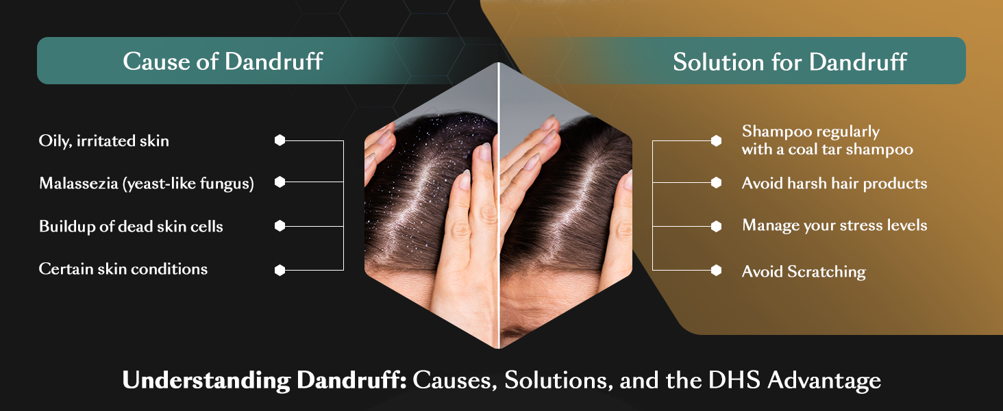 Understanding Dandruff: Causes, Solutions, and the DHS Advantage