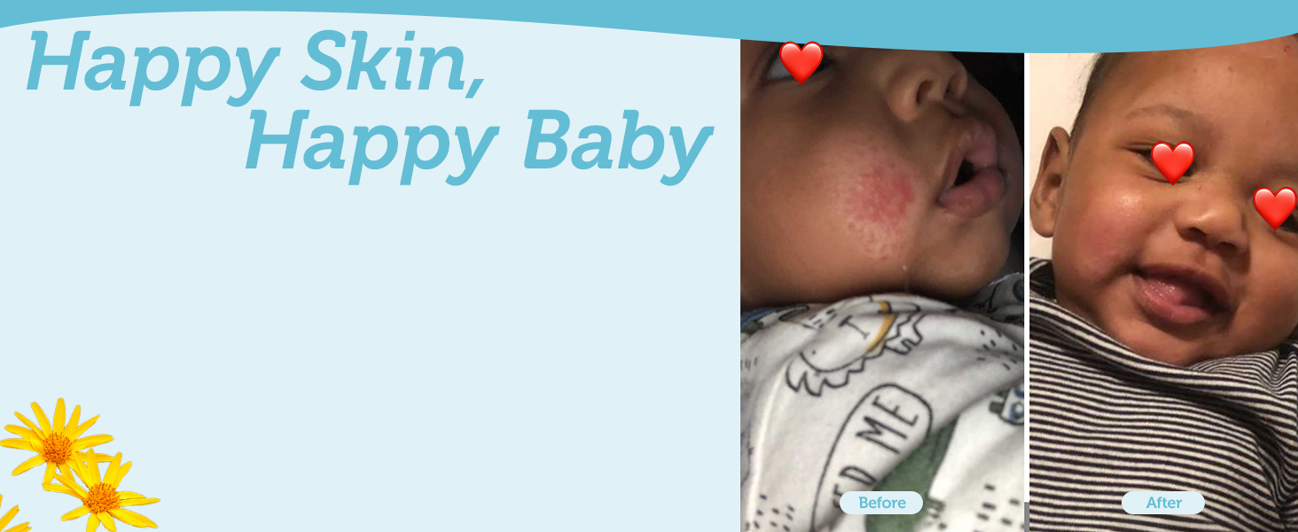 Organics Healing Ointment for Babies - USDA