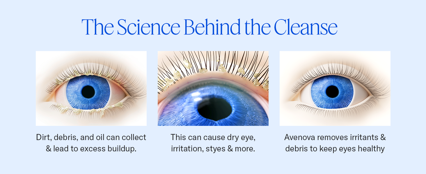 Debris and oil can cause dry eye, irritation, and more. Avenova removes irritants.