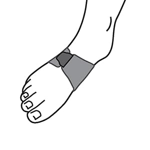 illustration of support fitting on right foot arch