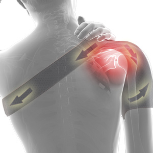 SHOULDER PAIN