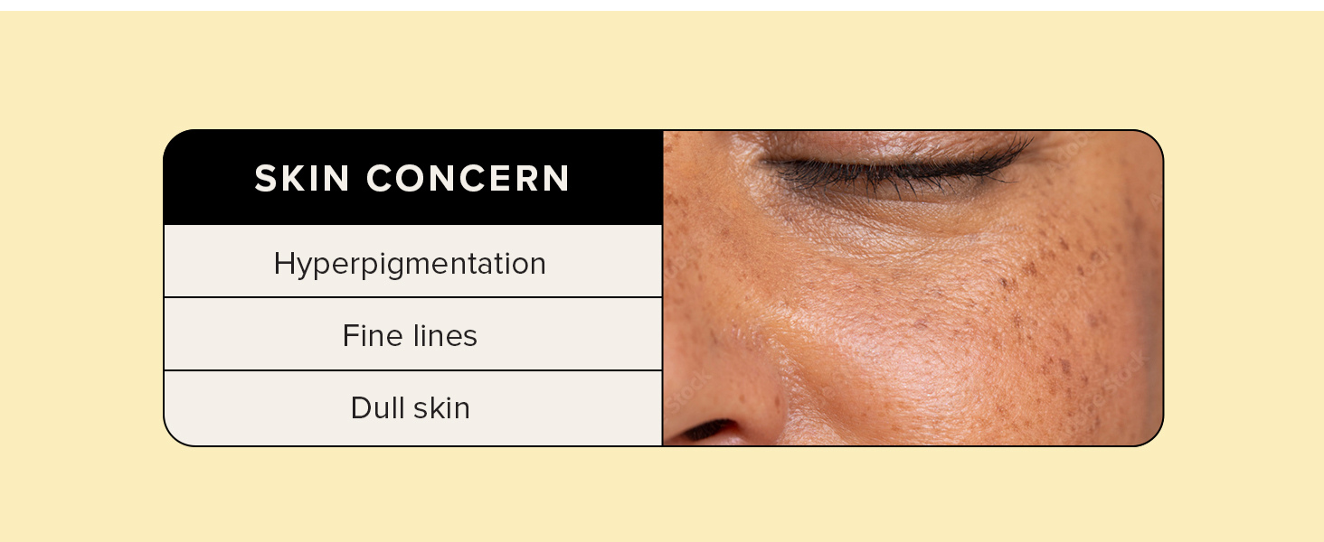 asterwood vitamin c for hyperpigmentation, fine lines, dull skin