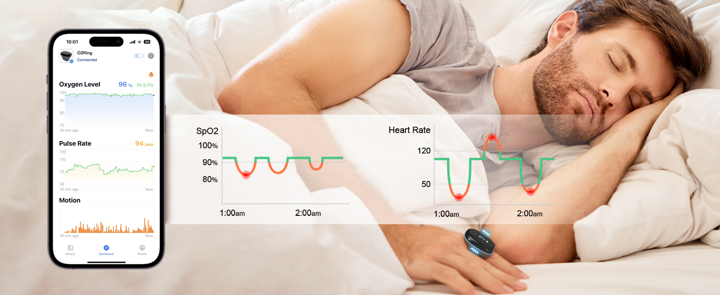 overnight pulse oximeter
