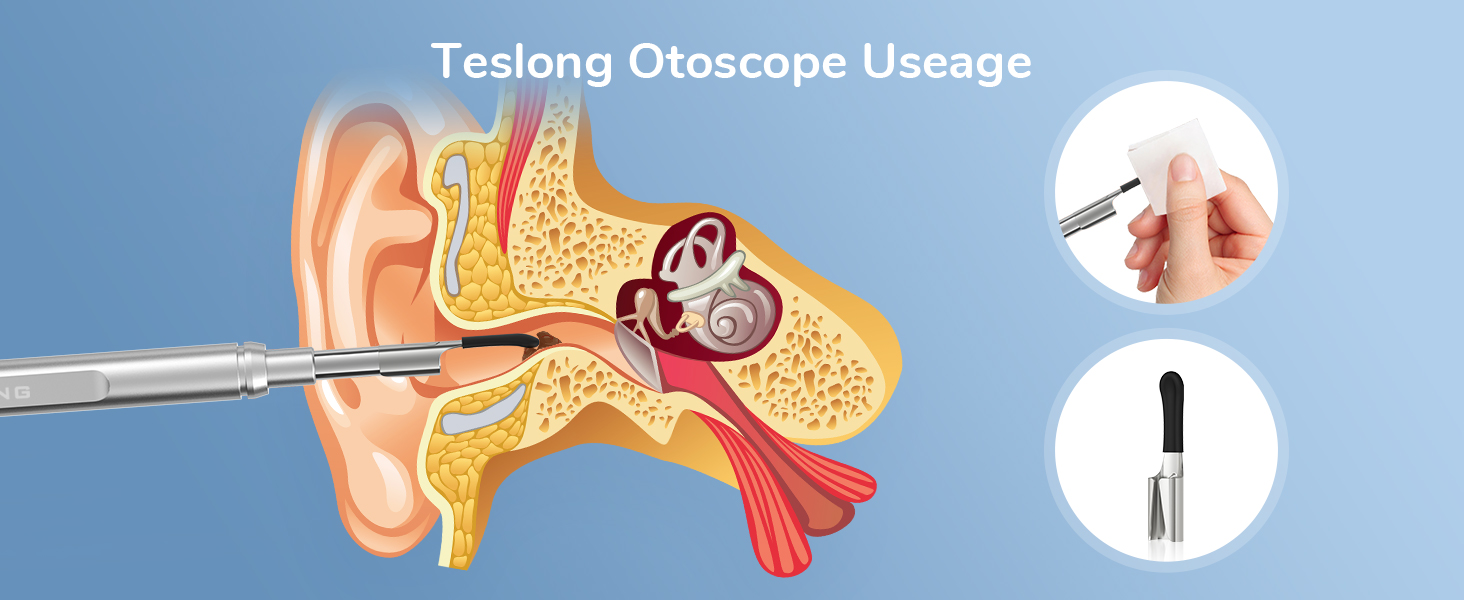 digital otoscope