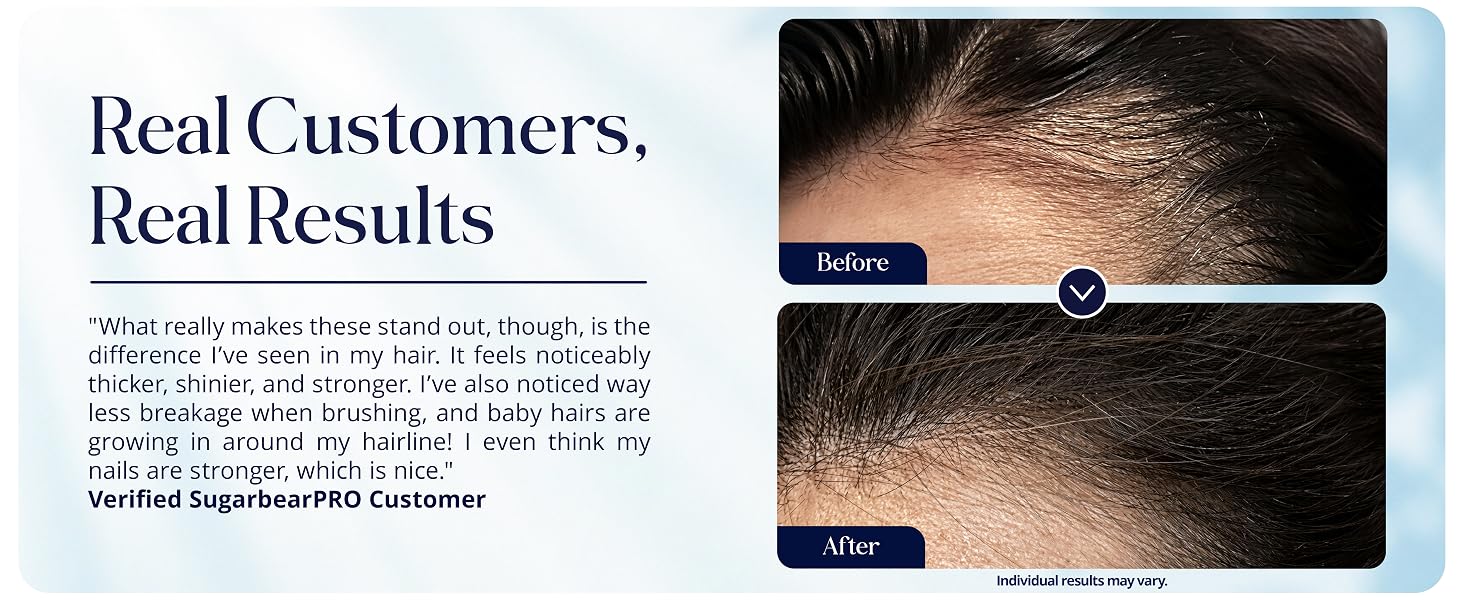 Hair support gummies with customer results and individual hair wellness journey