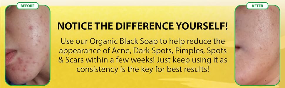 African Black Soap
