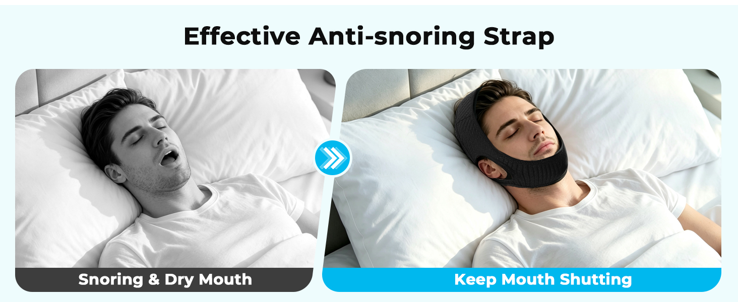 anti snoring chin strap