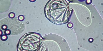 Fig B