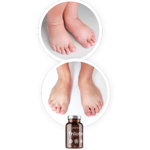 DON’T LET SWELLING SLOW YOU DOWN!