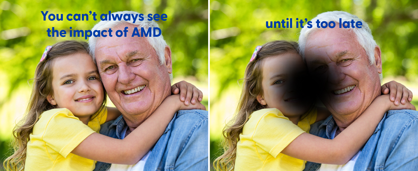 You can&amp;#39;t always see the impact of AMD until it&amp;#39;s too late