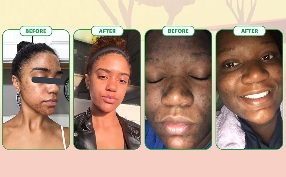African Black Soap