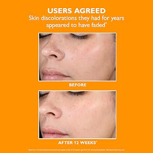 Potent-C Niacinamide Discoloration Treatment, suggested usage