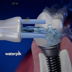 Using the Waterpik Plaque Seeker Tip