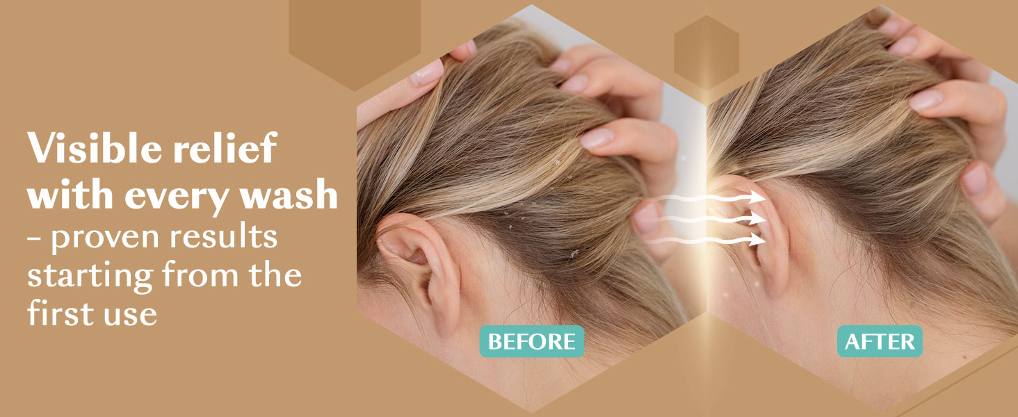 Visible relief with every wash – proven results starting from the first use.