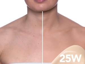 UNEVEN SKIN