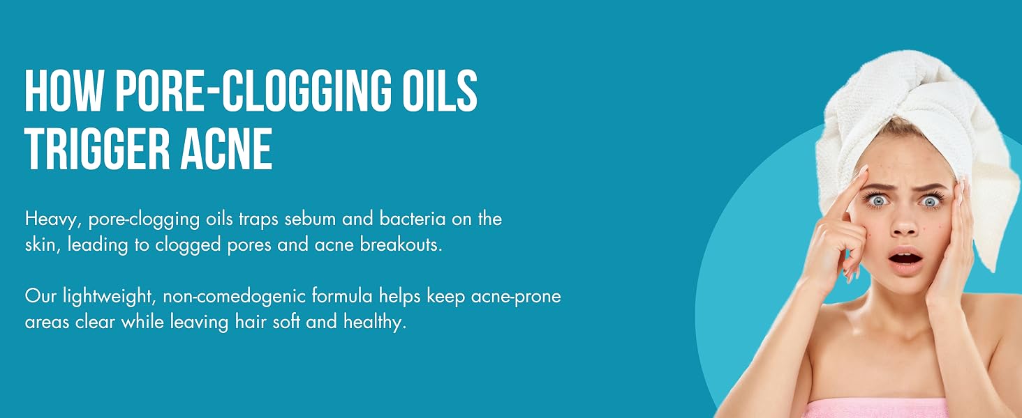 how pore clogging oils trigger acne
