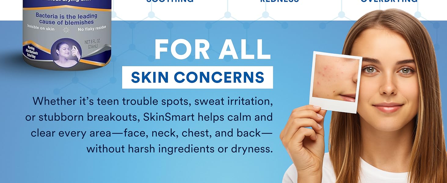 SkinSmart Antimicrobial Facial Cleanser For Acne, Targets Bacteria For Active Teenage Athletes