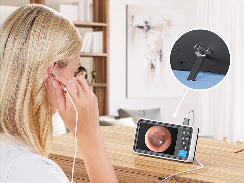 otoscope