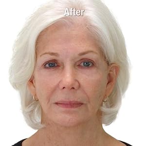 image of fifty five year old woman after using Insta Tox, skin is firmer with less visible wrinkles