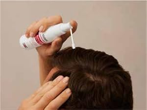 hair growth loss caida pelo crecepelo crecimiento cabello scalp coverage regrowth bald
