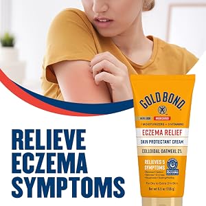 OTC eczema remedy