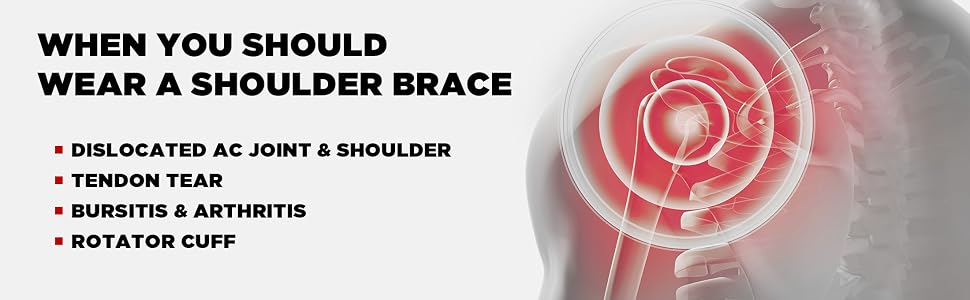When you should wear a shoulder brace.