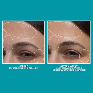 b&amp;amp;amp;a, b and a, before and after, usage