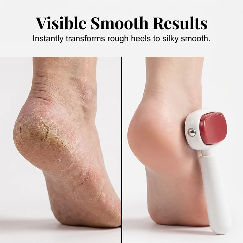 Visible foot smoothing results