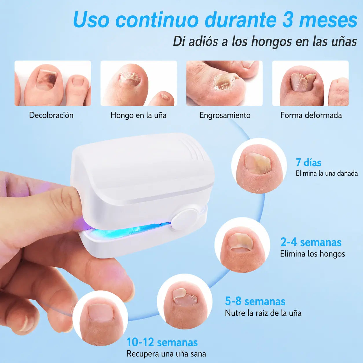 OnyCure v3™ | La luz LED que por fin llega al hongo bajo la uña — 7 minutos al día en casa, sin dolor. (30 días de prueba: o ves la base salir sana, o te devolvemos cada euro) 