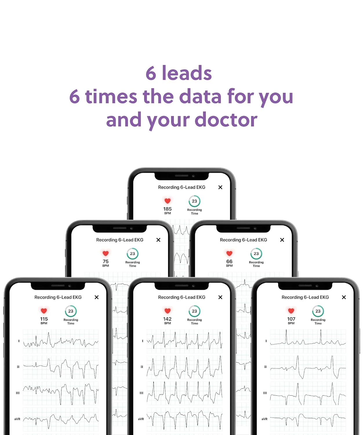 AliveCor KardiaMobile 6L Personal EKG Device and Heart Monitor | Detect AFib and PVCs from Home | 6 Arrhythmia Detections with KardiaCare (Includes 1
