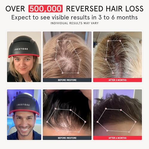 iRESTORE Elite Laser Hair Growth System - World's Best FDA Cleared Red Light Therapy Cap for Hair Regrowth - Hair loss Treatment for Men & Women