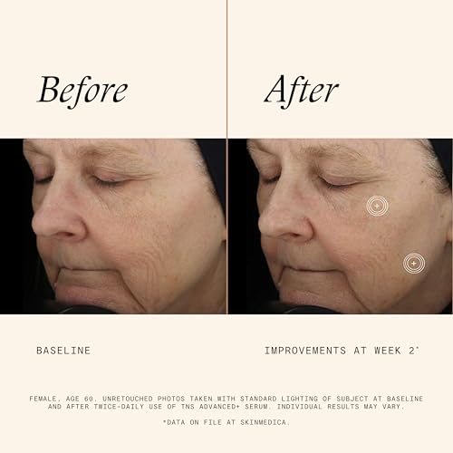 SkinMedica TNS Advanced+ Serum - Our Premium Facial Skin Care Product