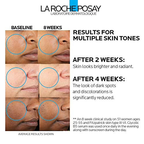 La Roche-Posay Glycolic Acid Serum with Kojic Acid and Vitamin B5, Reduces Dark Spots and Discoloration