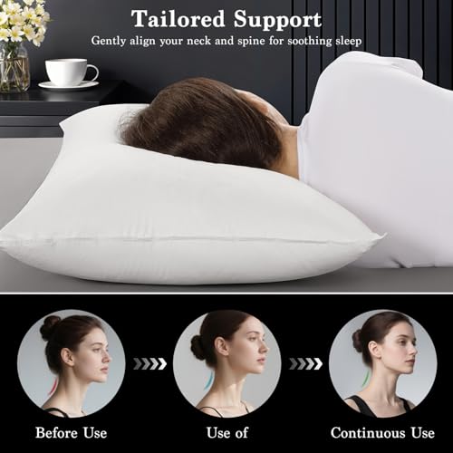 Shilucheng Goose Down and Feather Pillows Queen Size Set of 2 Pack, Luxury Hotel Quality Bed Pillows for Side Back Stomach Sleepers