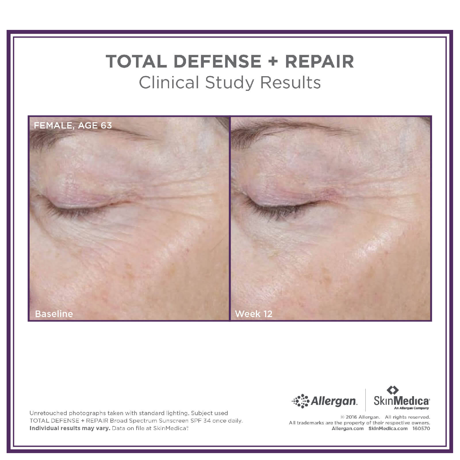 SkinMedica Total Defense + Repair SPF 34 - Tinted (2.3oz)