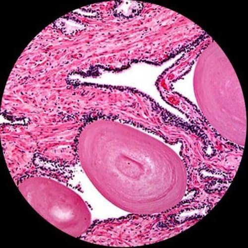 AmScope T390B-3M Digital Professional Compound Trinocular Microscope, 40X-2000X Magnification, WF10x and WF20x Eyepieces, Brightfield