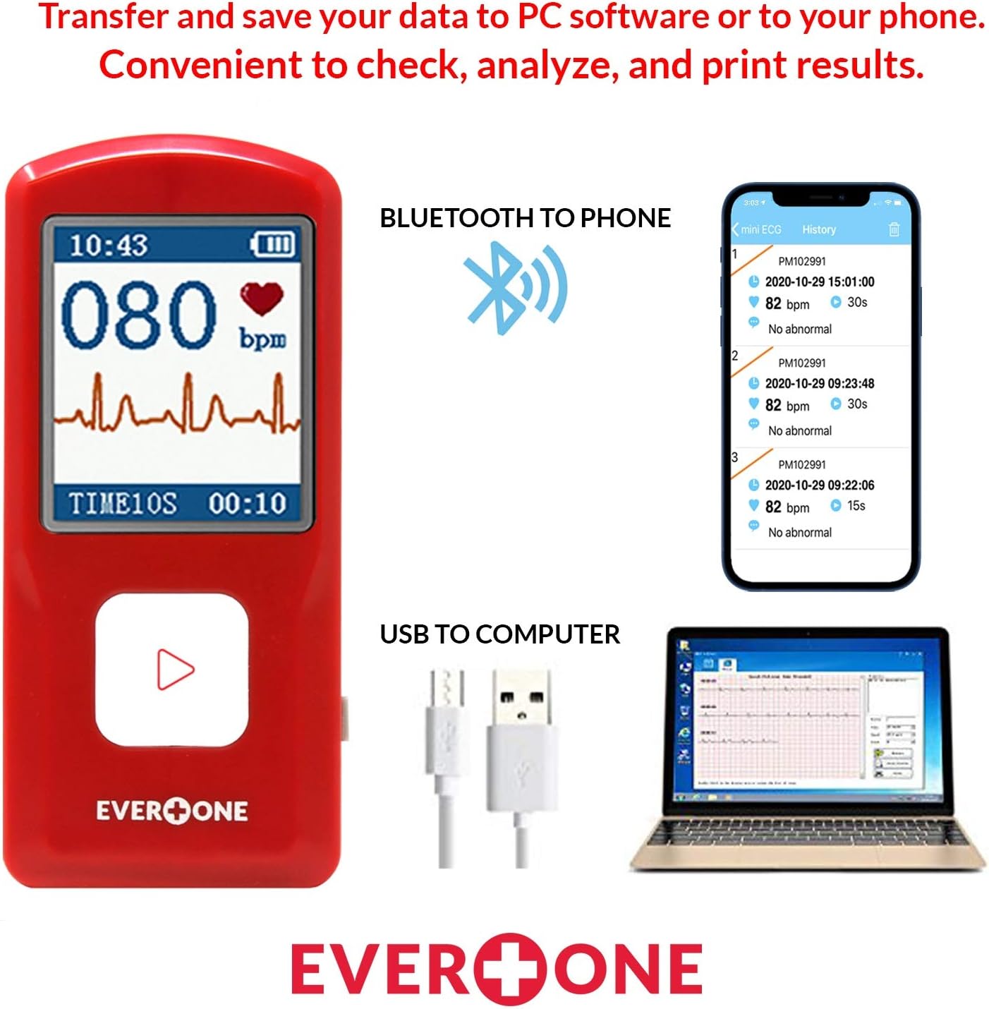 EVOPM10 Portable Bluetooth ECG/EKG Monitor, Compatible with iOS/Android, Windows 7/8/10, Track Heart Rate & Heart Rhythm Performance, App Included