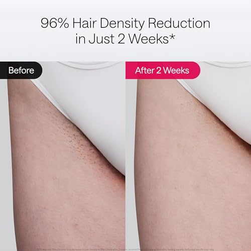 Ulike Laser Hair Removal Device Air 10 Ipl Gift for Women and Men, Ice Cool and Permanent Hair Reduction for Nearly Painless, Dual Lights