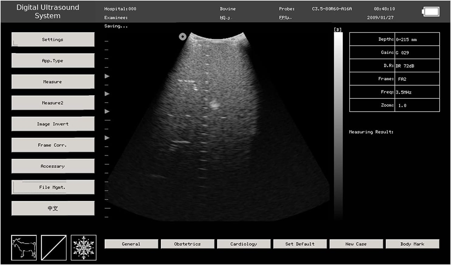 CONTEC USA Veterinary Laptop Machine Ultrasound Scanner Newest Horse/Equine/Cow/Sheep use (Convex & Rectal Linear Probe)