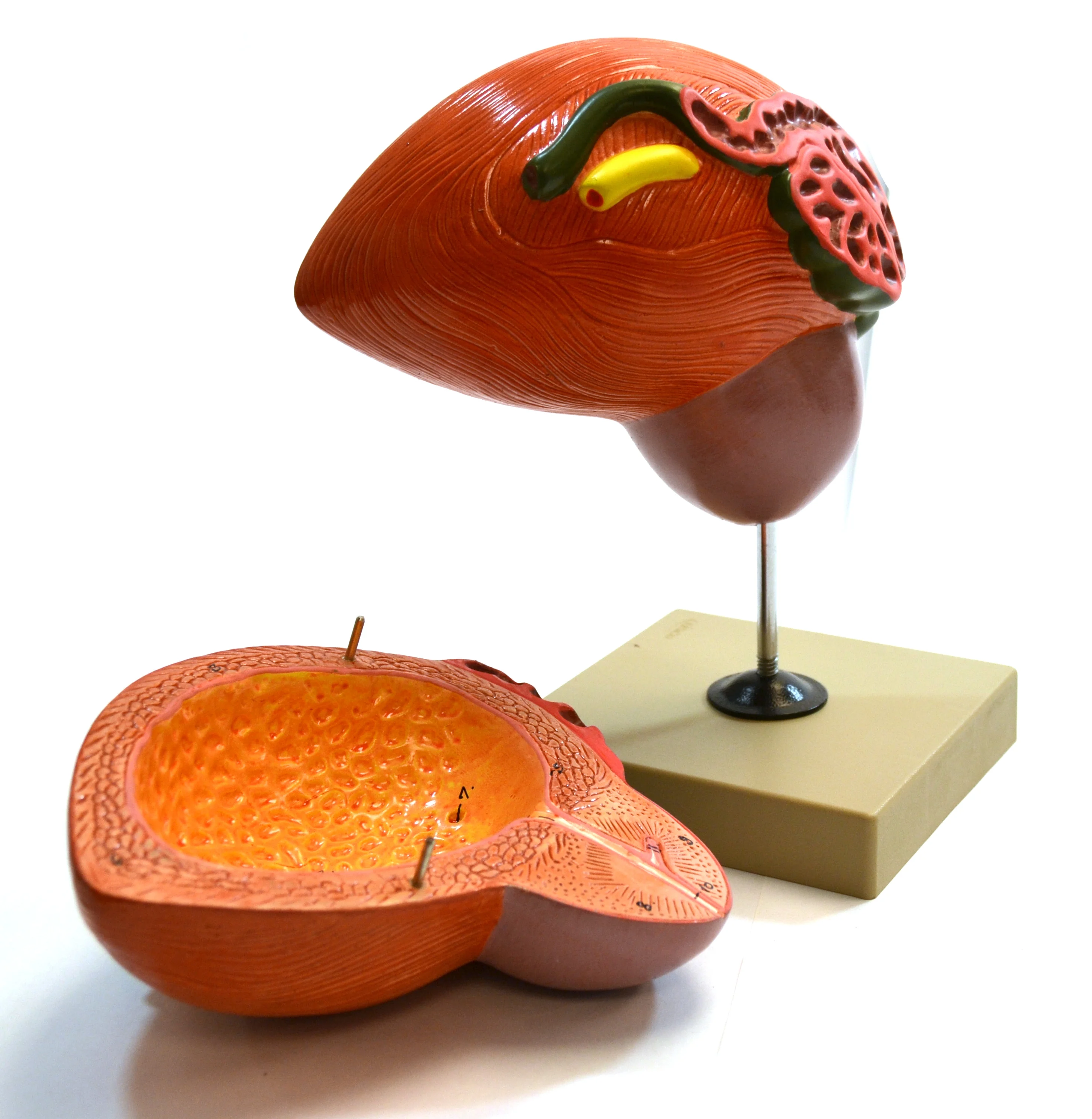 Eisco Labs Human Urinary Bladder with Prostate Anatomical Model, 2 Parts, 3 Times Life Size