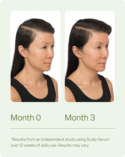 Divi Hair Scalp Serum for Women and Men - Revitalize and Balance Your Scalp - Improves Appearance of Thinning Hair