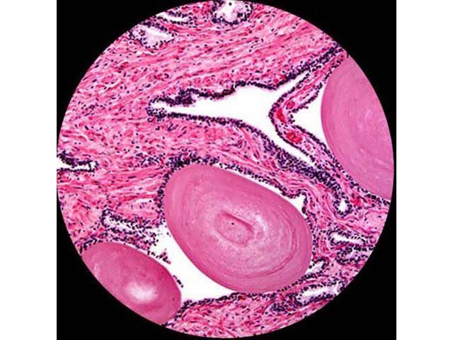 Amscope - 2000X LED Lab Trinocular Compound Microscope W 3D Mechanical Stage + 5MP Camera