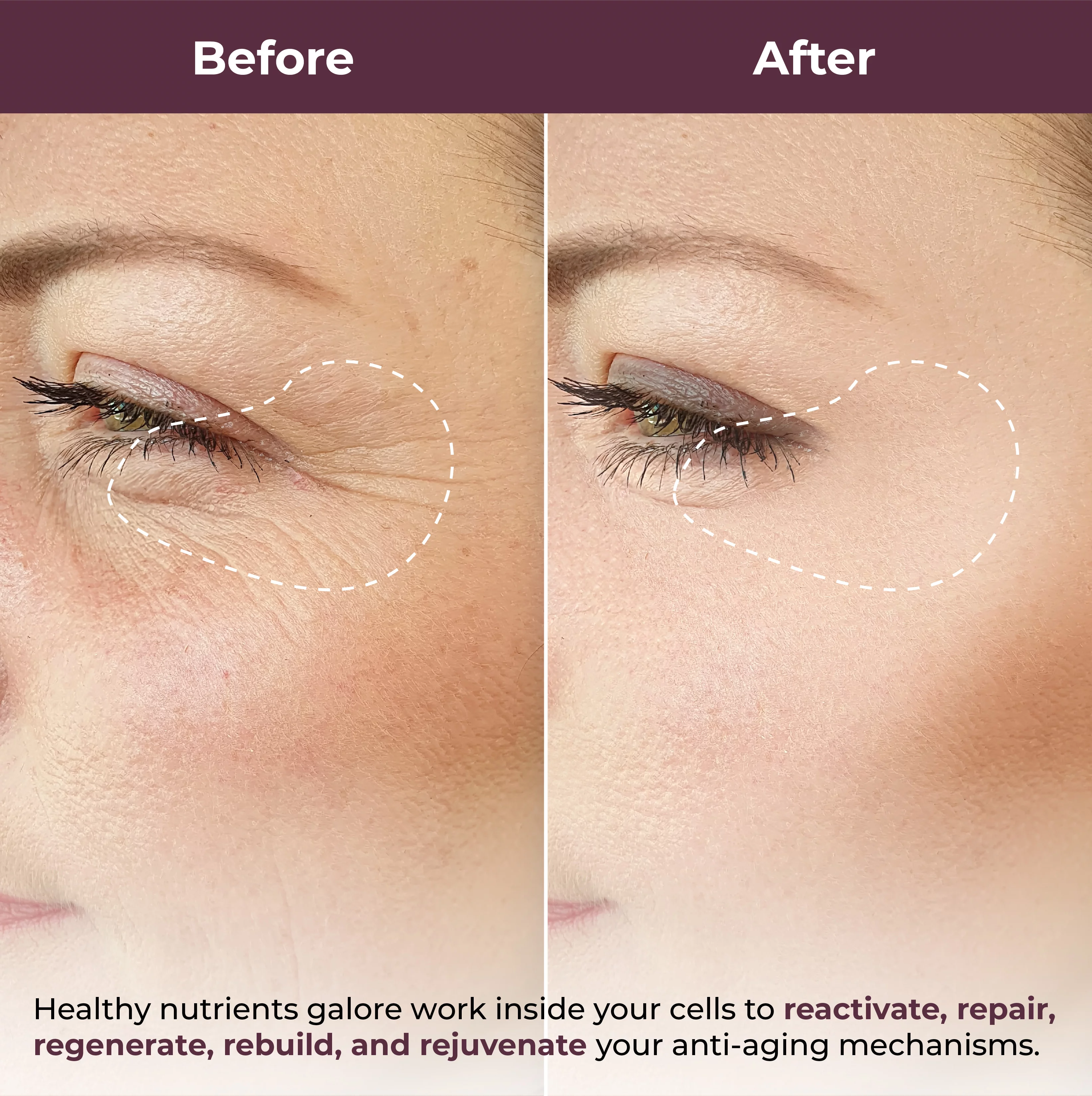 PURA Lift Instant Under Eye Serum - Advanced Dark Circle Reducer, Anti Aging Serum - Reduces Wrinkles, Under-Eye Puffy Bags
