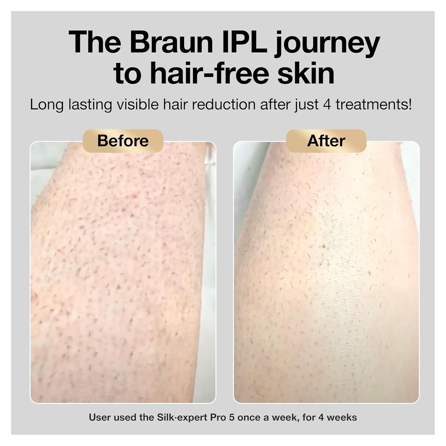 Braun IPL Long-lasting Laser Hair Removal Device for Women & Men, Silk Expert Pro5 PL5157